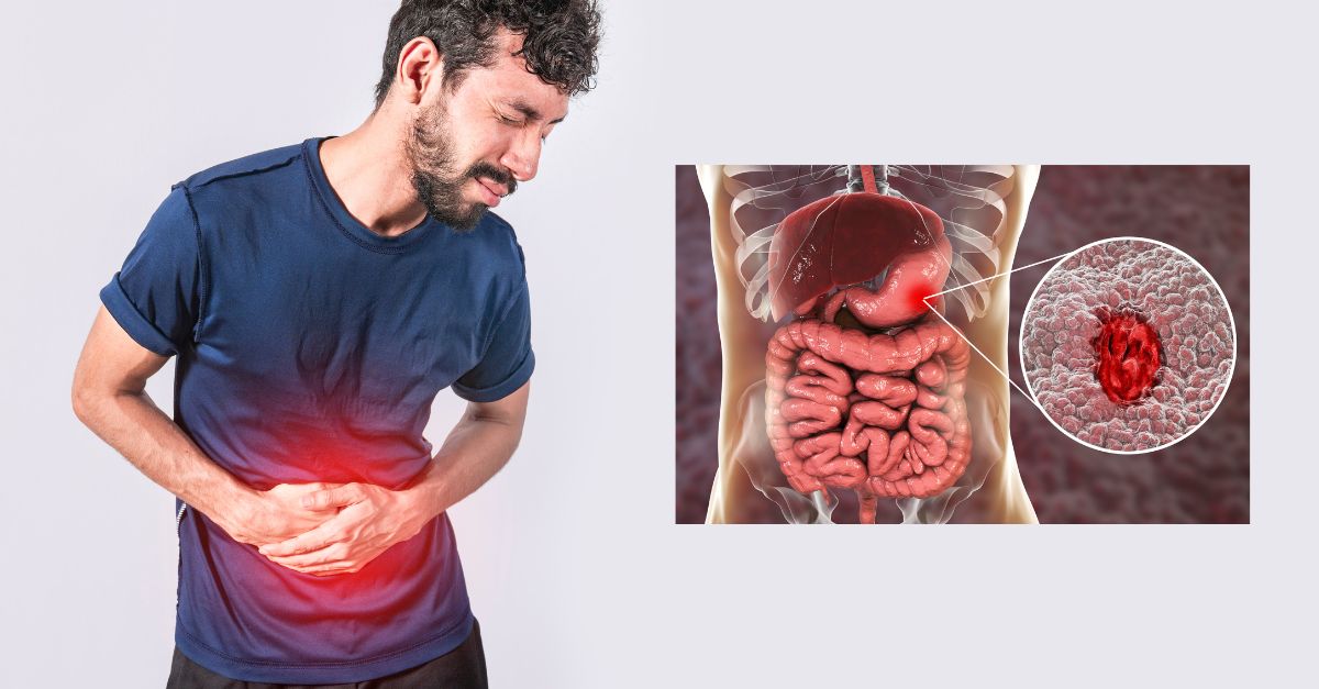 These IBS Treatments Are Finally Bringing Relief To Digestive Pain ...